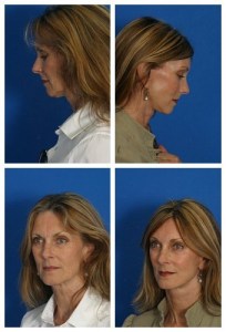 composite_16038900642986