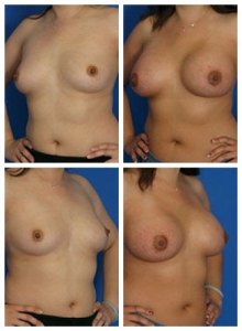 composite_16040480993903