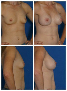 composite_16040481495868