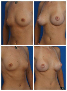 composite_16040483049874