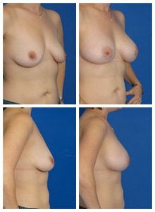 composite_16040484584512