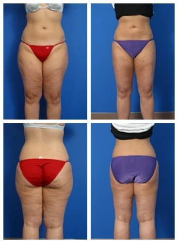 composite_16039622695830