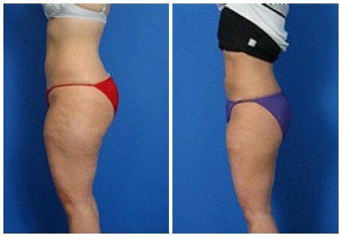 composite_16039623175383