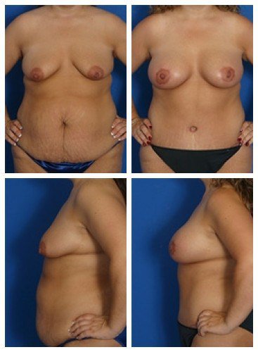 composite_16039590491836