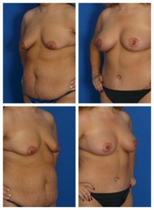 composite_16039590905913