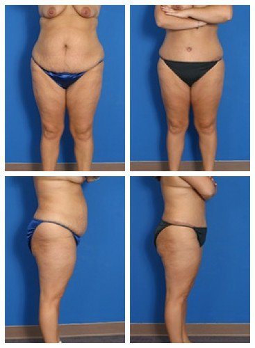 composite_16039591193168