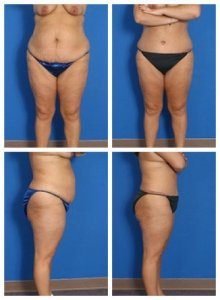 composite_16039591193168