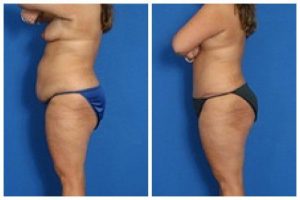 composite_16039591728771