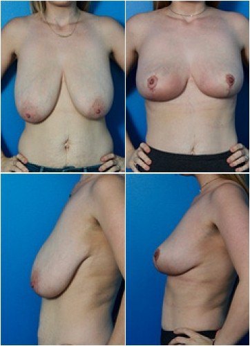 composite_16039636384877