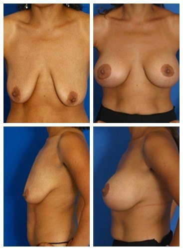 composite_16039781798375