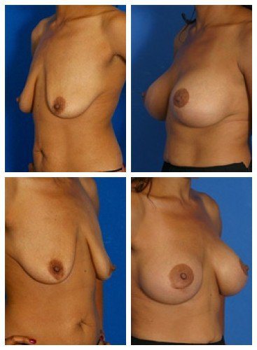 composite_16039782248584