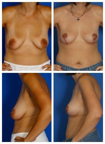 composite_16039789122472