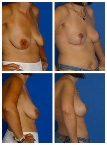 composite_16039789486239