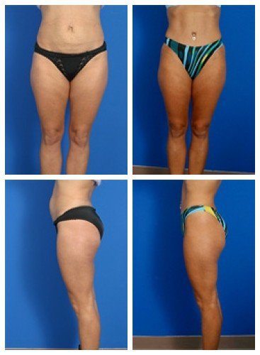 composite_16039702179421