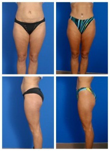 composite_16039702179421