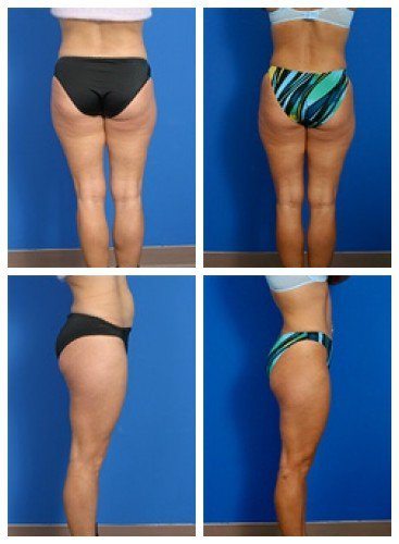 composite_16039702476985