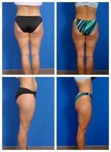 composite_16039702476985