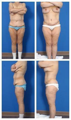 composite_16039616247333