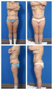 composite_16039616247333