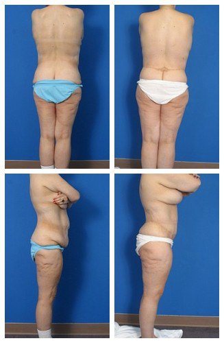 composite_16039616752223