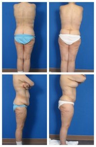 composite_16039616752223