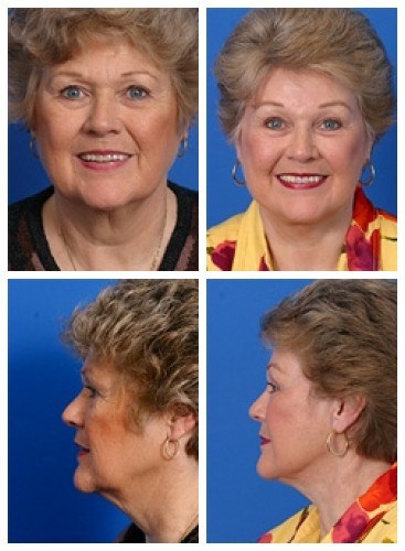 composite_16038901265912