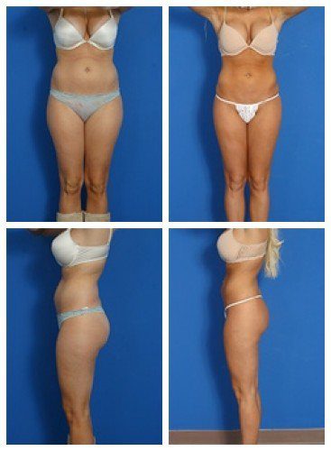 composite_16039623522786