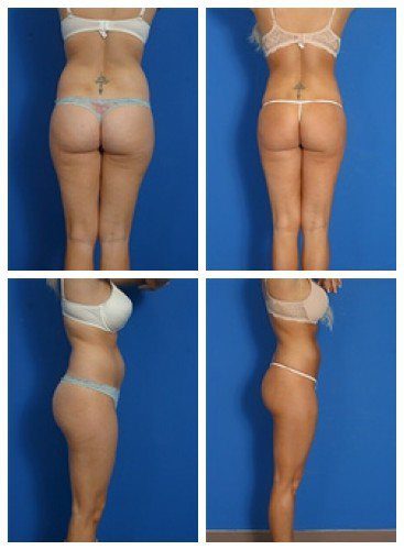 composite_16039623879194