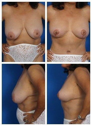 composite_16039637212480