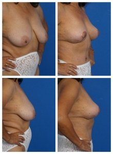 composite_16039647407197