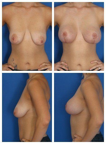 composite_16039782561761