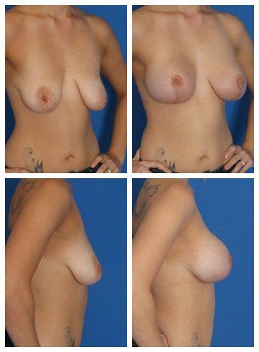 composite_16039782888325