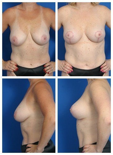 composite_16039789768390