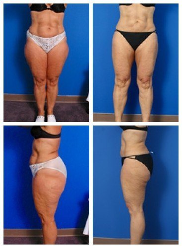 composite_16039702889089