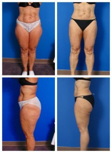 composite_16039702889089