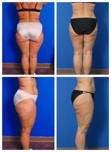 composite_16039703234616