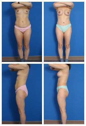 composite_16039592334656