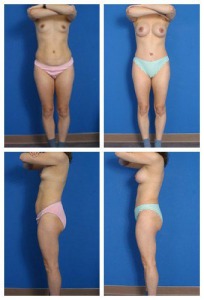 composite_16039592334656