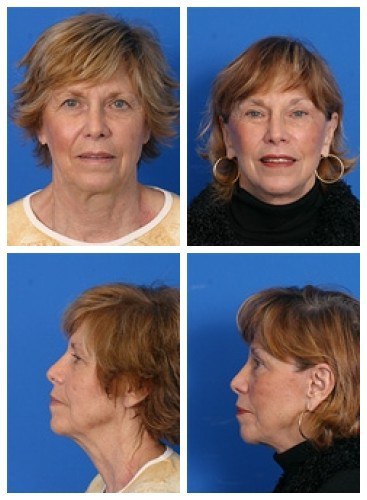 composite_16038903534685