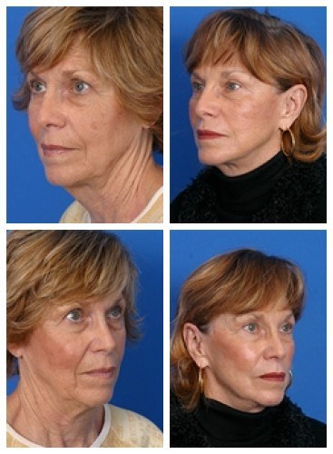 composite_16038903891585