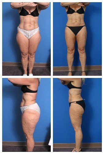 composite_16039624245712