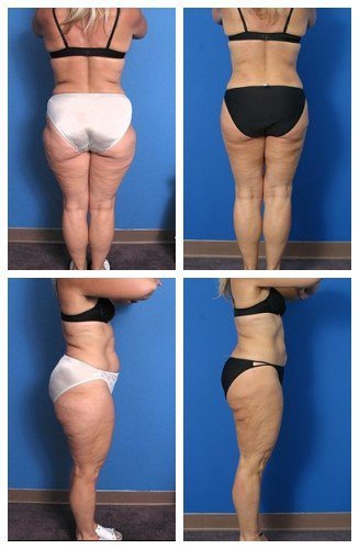 composite_16039624622030