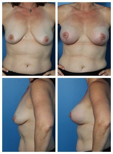 composite_16039783336670