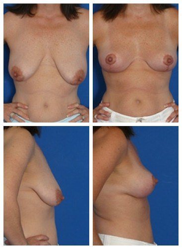 composite_16039790383767