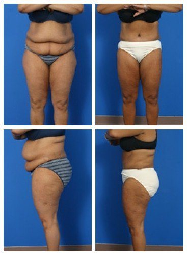 composite_16039703524665