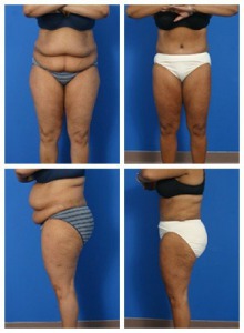 composite_16039703524665