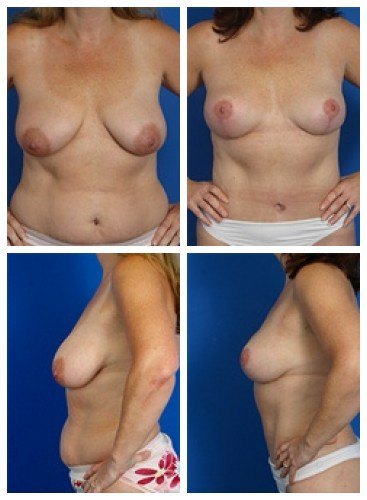 composite_16039592767056