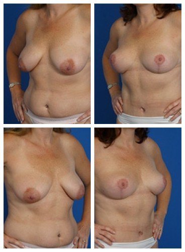 composite_16039593225100