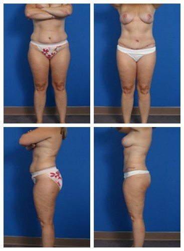 composite_16039593475134