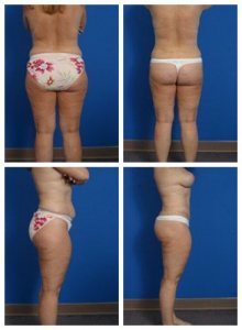 composite_16039593836591